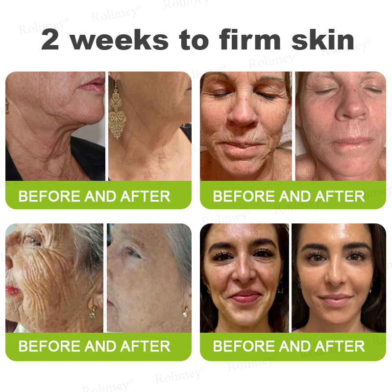 🎈❣️Made and shipped from the USA 💫Rolimey® Botox & Vita-A Retinol Shot Wrinkle-Lift Tightening cream - Last Day Promotion 70% OFF