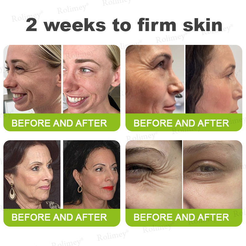🎈❣️Made and shipped from the USA 💫Rolimey® Botox & Vita-A Retinol Shot Wrinkle-Lift Tightening cream - Last Day Promotion 70% OFF