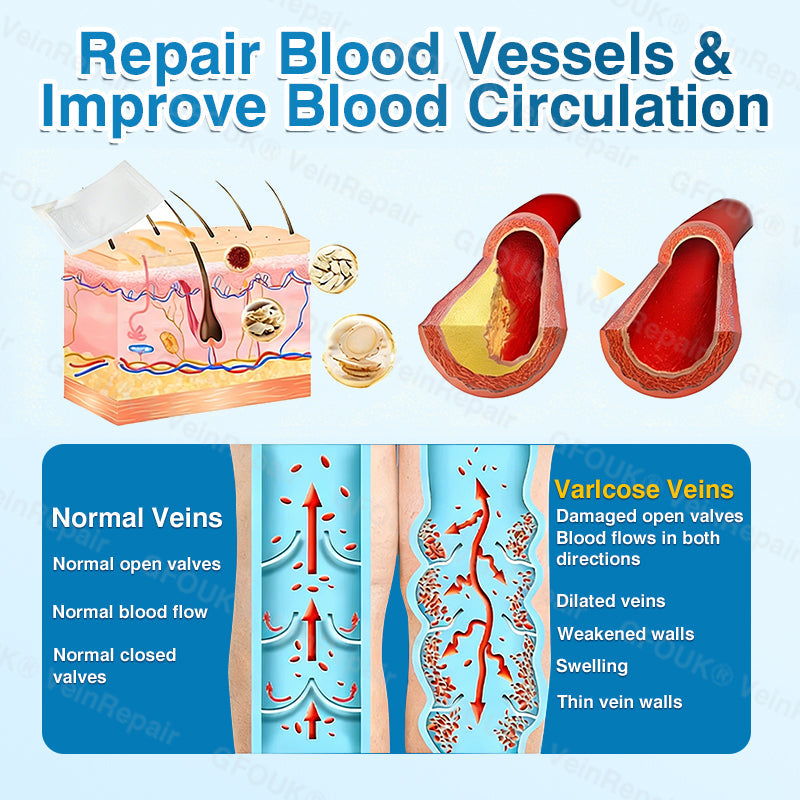 🇺🇸🏅🌱AIYNS Official Store -  VeinRepair Microneedle Patch Roll⚡Instant Relief, Long-Term Results