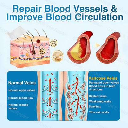 🇺🇸🏅🌱AIYNS Official Store -  VeinRepair Microneedle Patch Roll⚡Instant Relief, Long-Term Results