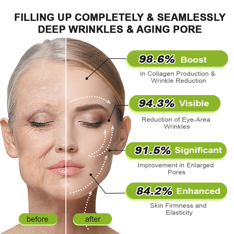 🎈❣️Made and shipped from the USA 💫Rolimey® Botox & Vita-A Retinol Shot Wrinkle-Lift Tightening cream - Last Day Promotion 70% OFF