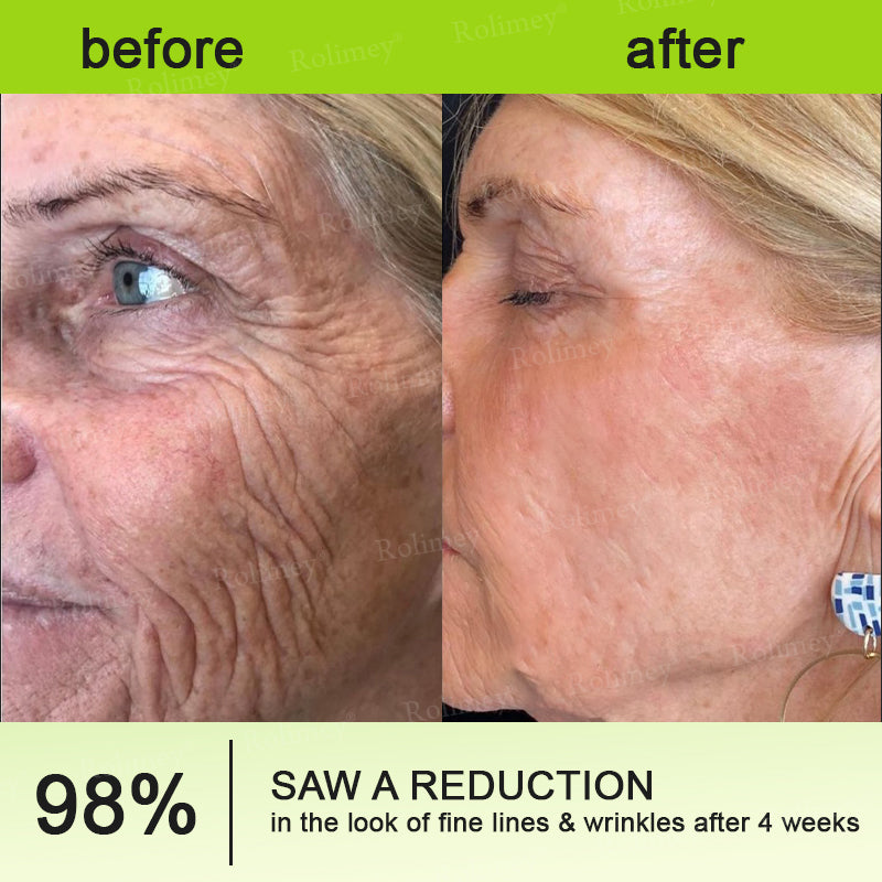 🎈❣️Made and shipped from the USA 💫Rolimey® Botox & Vita-A Retinol Shot Wrinkle-Lift Tightening cream - Last Day Promotion 70% OFF