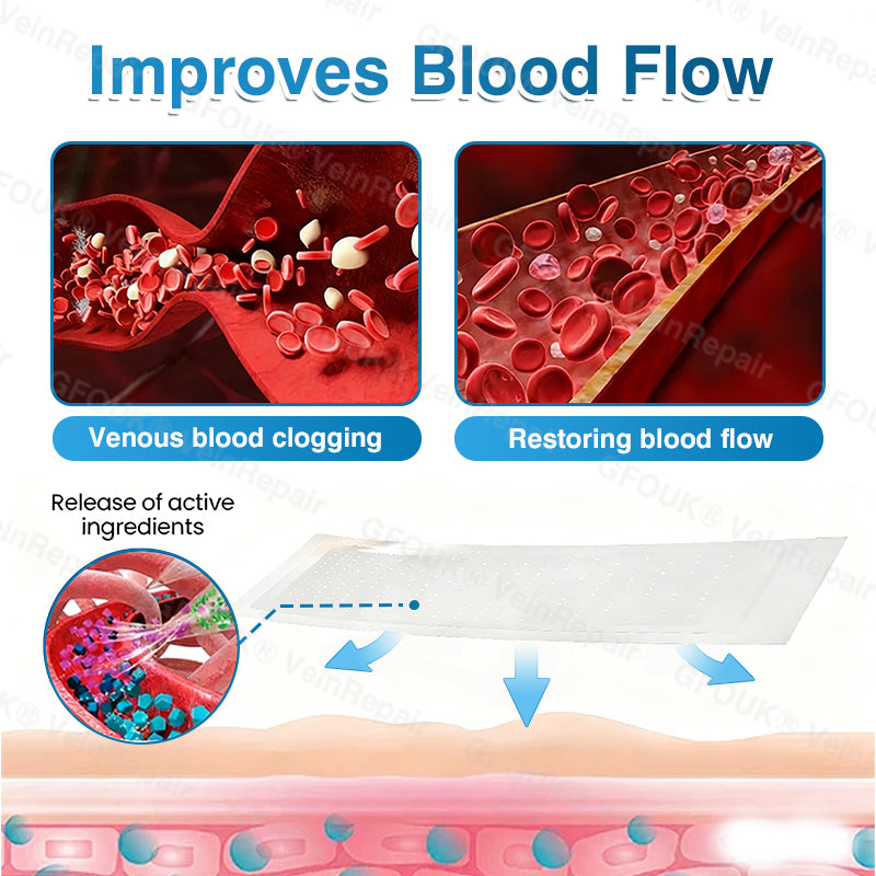 🇺🇸🏅🌱AIYNS Official Store -  VeinRepair Microneedle Patch Roll⚡Instant Relief, Long-Term Results