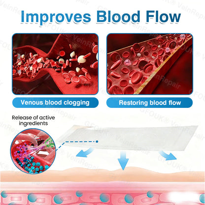 🇺🇸🏅🌱AIYNS Official Store -  VeinRepair Microneedle Patch Roll⚡Instant Relief, Long-Term Results
