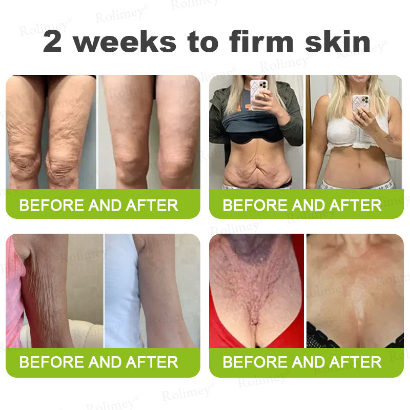 🎈❣️Made and shipped from the USA 💫Rolimey® Botox & Vita-A Retinol Shot Wrinkle-Lift Tightening cream - Last Day Promotion 70% OFF