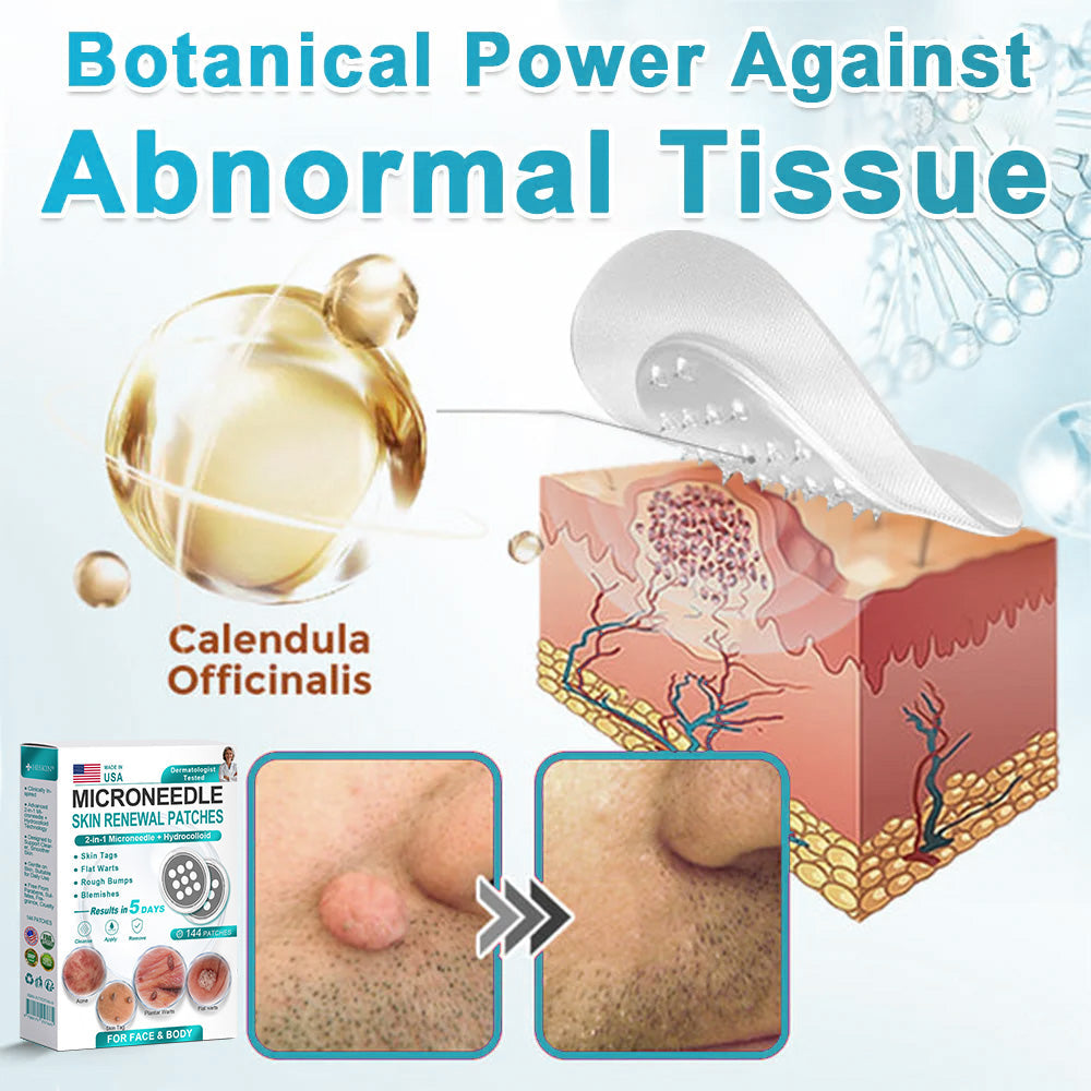 AIYNS Official Store -  2-in-1 Microneedle & Hydrocolloid Patch👨‍⚕️ | Removes raised moles, acne, flat warts, and skin tags | Helps improve wrinkles, scars, and blemishes | Invisible patches for face and body