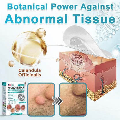 AIYNS Official Store -  2-in-1 Microneedle & Hydrocolloid Patch👨‍⚕️ | Removes raised moles, acne, flat warts, and skin tags | Helps improve wrinkles, scars, and blemishes | Invisible patches for face and body