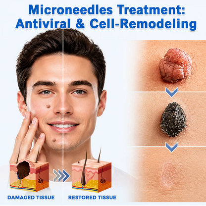 AIYNS Official Store -  2-in-1 Microneedle & Hydrocolloid Patch👨‍⚕️ | Removes raised moles, acne, flat warts, and skin tags | Helps improve wrinkles, scars, and blemishes | Invisible patches for face and body
