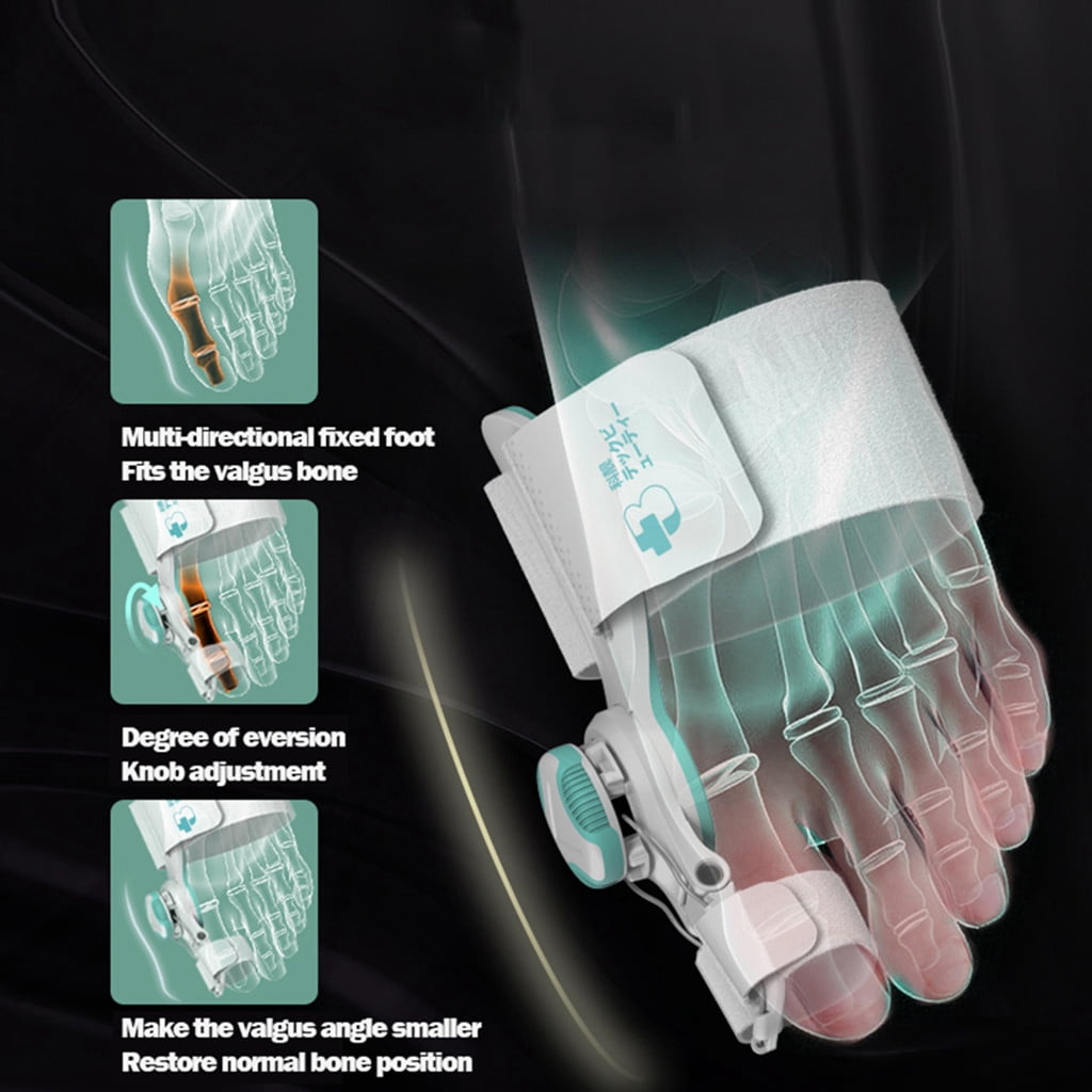 Big Toe Straightener Adjustable Toe Corrector Knob Hallux Valgus Correction Toe Bunion Separators Foot Care Supplies