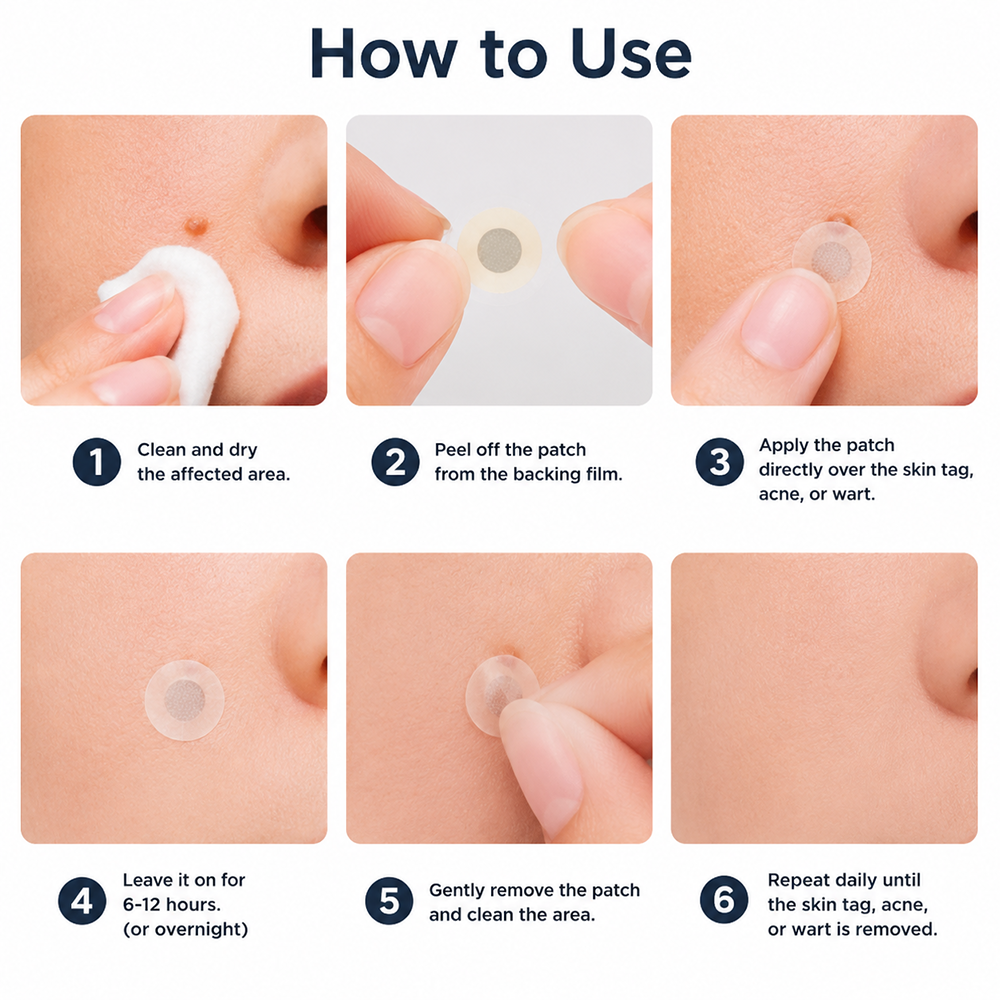 AIYNS Official Store -  2-in-1 Microneedle & Hydrocolloid Patch👨‍⚕️ | Removes raised moles, acne, flat warts, and skin tags | Helps improve wrinkles, scars, and blemishes | Invisible patches for face and body