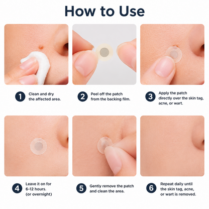 AIYNS Official Store -  2-in-1 Microneedle & Hydrocolloid Patch👨‍⚕️ | Removes raised moles, acne, flat warts, and skin tags | Helps improve wrinkles, scars, and blemishes | Invisible patches for face and body