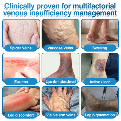 🇺🇸🏅🌱AIYNS Official Store -  VeinRepair Microneedle Patch Roll⚡Instant Relief, Long-Term Results