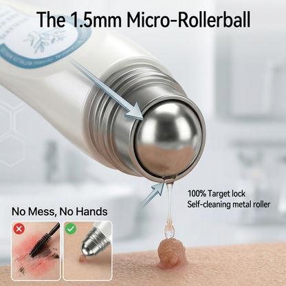 AIYNS Official Store - 7 𝐷𝑎𝑦 𝗧𝐚𝐠 & 𝗦𝗽𝐨𝐭 𝐄𝐫𝒂𝒔𝒆𝒓(Zero Pain, Zero 𝐒𝐜𝐚𝒓𝒔 Rollerball)💎