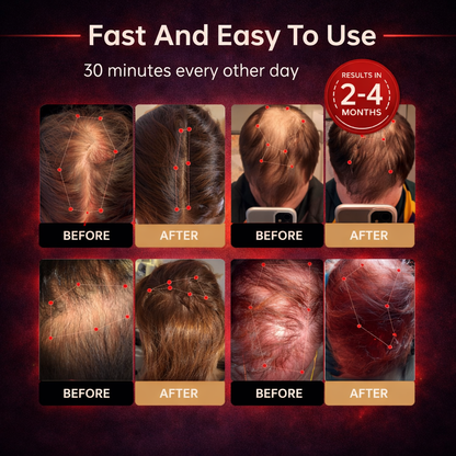🔥Red Light Therapy Regrowth Cap